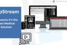 SepStream 7 Reasons It’s the Best Medical Solution